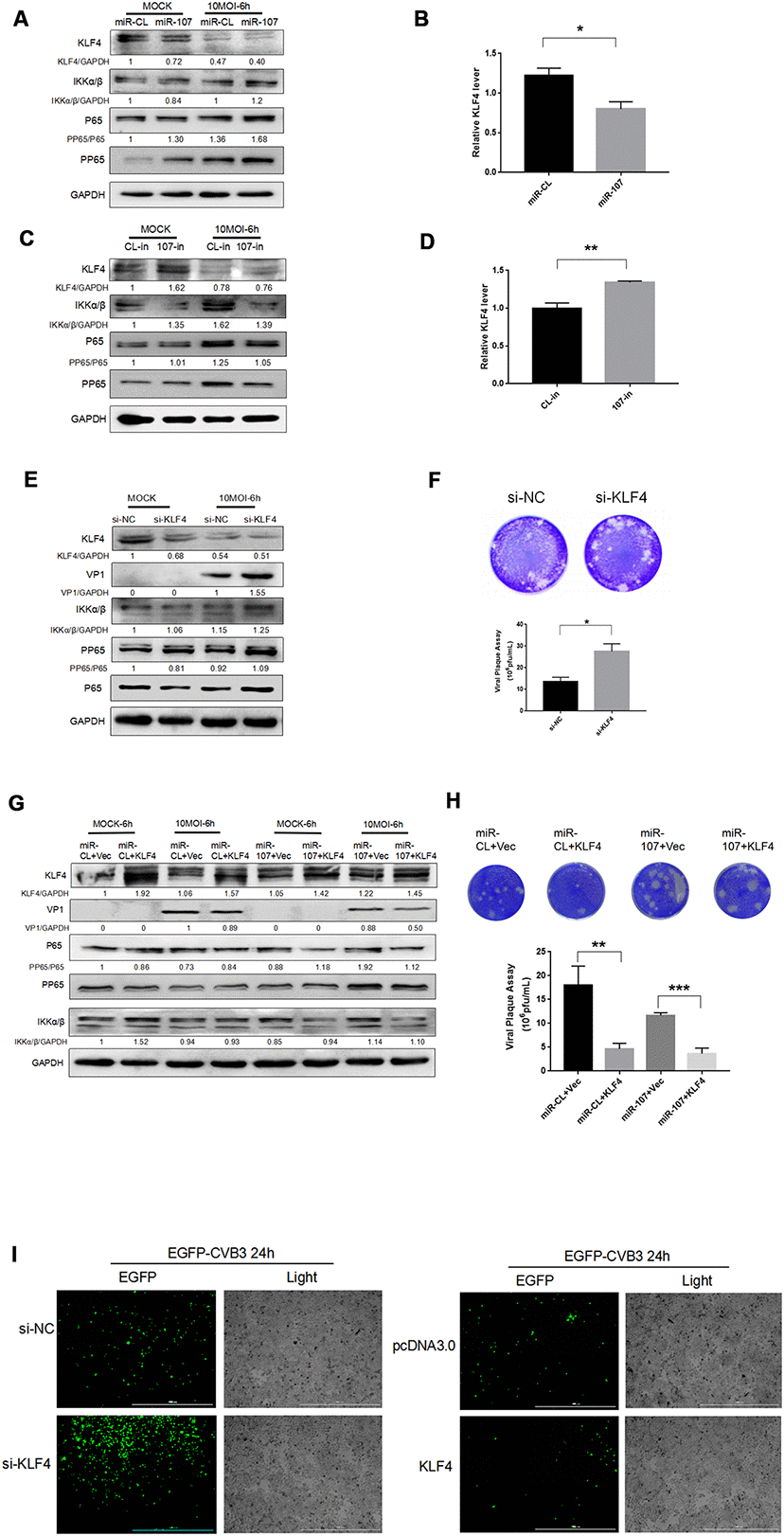 (A–D) MiR-107 targeted KLF4, enhanced phosphorylation of NFκB and promoted replication of CVB3. Hela cells was infected with CVB3 after transfection with miRNA mimics or inhibitors. Cellular proteins were detected by western blot. RT-qPCR was performed to determine the mRNA level of KLF4. (E) KLF4 knockdown facilitated the phosphorylation of NFκB. Hela cells which were initially transfected with KLF4 siRNA were infected with CVB3. Protein expressions of NFκB and p-NFκB were detected by western blot analysis. (F, H) Viral titers were determined by plaque assay. (G) The overexpression of KLF4 partially suppressed the promoting effect of miR-107 on VP-1 synthesis and the phosphorylation of NFκB. Hela cells that were co-transfected with miRNA mimics and KLF4 plasmids or empty vector (Vec) were infected with CVB3 afterward. The activity of NFκB signaling was analyzed by western blot. (I) The replication level of EGFP-Iabeled CVB3 was observed in Hela cells which had been transfected with si-KLF4 or pcDNA-KLF4 (magnification, 4×).