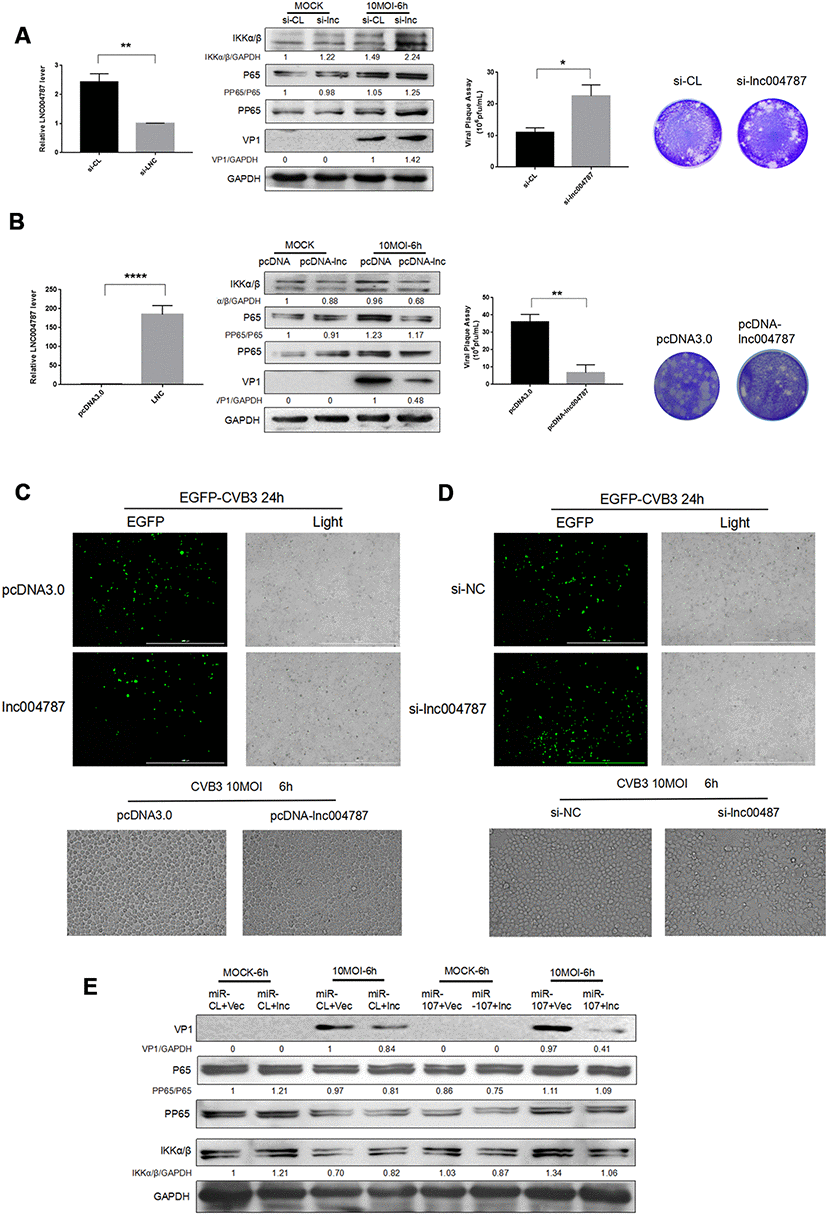 (A–B) After the knockdown or overexpression of IncRNA004787, RT-qPCR was performed for detecting its level changes. VP-1 and plaque assay were adopted for assessing CVB3 replication and virus release in Hela cells. (C–D) The replication level of EGFP-Iabeled CVB3 was observed in Hela cells which had been transfected with pcDNA-lncRNA004787 or si-lncRNA004787 (magnification, 4×). The morphology of the cells and the extent of the lesions were observed under a microscope (magnification, 100×). (E) The overexpression of IncRNA004787 partially reversed the facilitating effect of miR-107 on the production of VP-1 and the phosphorylation of NFκB. The activity of NFκB signaling was detected using western blot.
