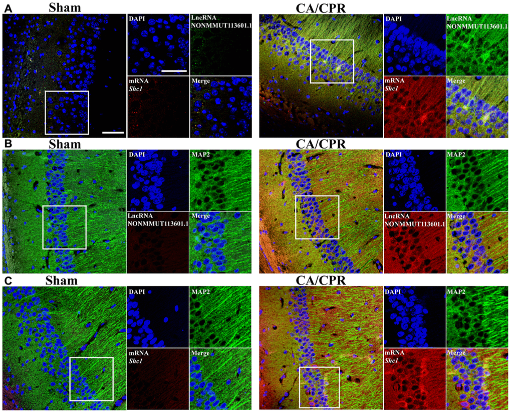 In situ hybridization of lncRNA and mRNA in neuron cells. (A) Biotin-labeled lncRNA and digoxigenin-labeled mRNA probes are shown in green and red, respectively. LncRNA and mRNA are co-expressed in CA1 of the hippocampus. (B, C) The colocation effect of LncRNA (B) or mRNA (C) with MAP-2 labeled neuron cells indicated these correlations mainly happened in neuron cells of the hippocampus. LncRNA and mRNA were labeled by red fluorescent probes, and he neuron cells were marked using anti-MAP2 antibody and Alexa 488 conjugated anti-rabbit IgG. Scale bar: 50 μm.