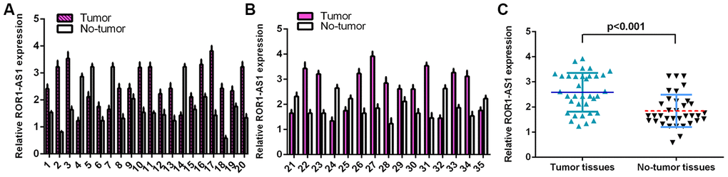 ROR1-AS1 level in osteosarcoma tissues. (A) The detail expression of ROR1-AS1 of case 1-20 was shown. (B) The detail expression of ROR1-AS1 of case 21-35 was shown. (C) ROR1-AS1 was higher in osteosarcoma tissues compared to no-tumor samples.