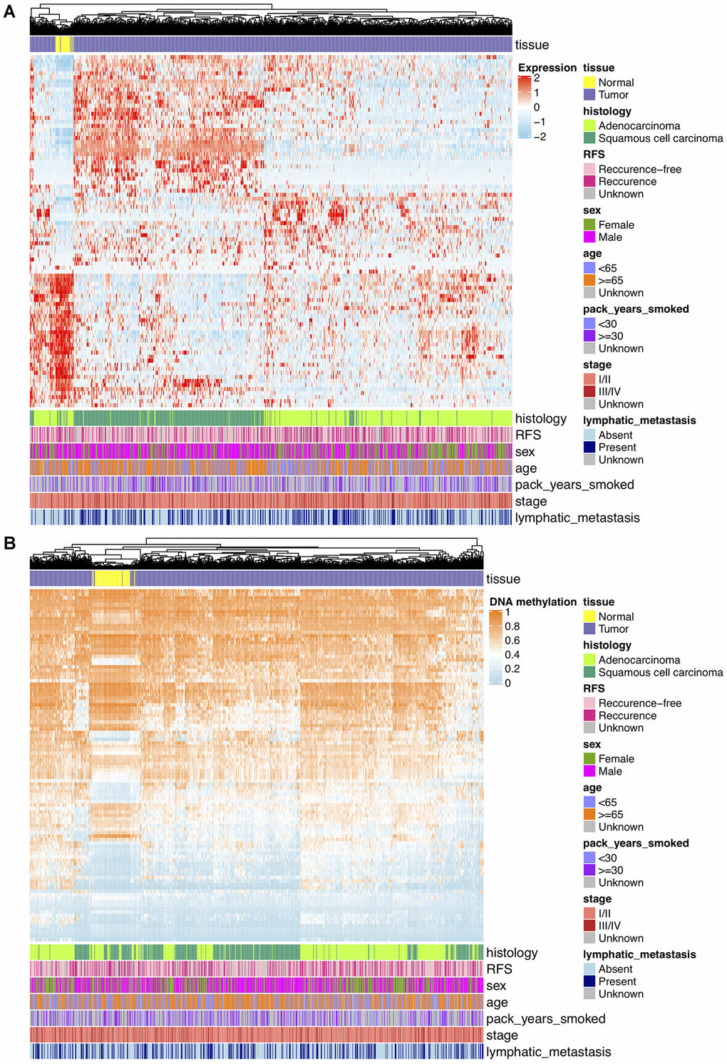 (A) Hierarchical clustering of 87 unique DEGs that potentially regulated by changes in DNAm levels at 102 selected loci based on TCGA NSCLC gene expression data (821 tumor and 28 normal samples). Clinical and demographic features, including age, sex, pack-years smoked, histology, stage, lymphatic metastasis and clinical outcome (RFS, recurrence-free survival status). High expression, red; low expression, skyblue. (B) Hierarchical clustering of 102 significantly DMPs between NSCLC (n=827) and normal (n=74) samples. Hopomethylated CpGs, skyblue; hypermethylated CpGs, orange.