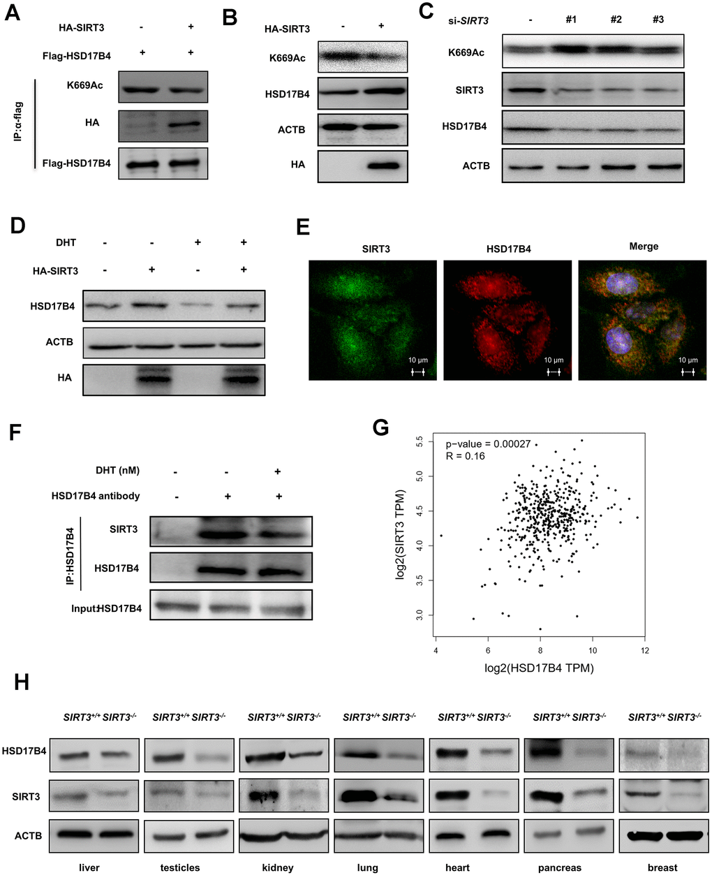 SIRT3 decreases the K669 acetylation level and stabilizes the protein level of HSD17B4. (A) SIRT3 overexpression decreases HSD17B4 acetylation. HA-tagged SIRT3 plasmid was cotransfected with FLAG-tagged HSD17B4 plasmid into LNCaP cells. Proteins were immunoprecipitated for western blotting. (B) SIRT3 overexpression causes accumulation of HSD17B4 protein. LNCaP cells were transfected with HA-SIRT3, and the protein levels of endogenous HSD17B4 were determined by western blotting. (C) SIRT3 knockdown decreases HSD17B4 protein. LNCaP cells were transfected with siSIRT3 or control. Cells were harvested 48 h after transfection, and cell lysates were analyzed by western blotting. (D) SIRT3 can rescue the protein levels of HSD17B4 that are decreased by DHT. LNCaP cells were transfected with HA-SIRT3 and untreated or treated with DHT. HSD17B4 protein levels were determined by western blotting. (E) SIRT3 colocalizes with HSD17B4. Cultured LNCaP cells were paraformaldehyde fixed, blocked, and processed for double immunofluorescence with antibodies against SIRT3 (green) and HSD17B4 (red). Merged images of both channels are shown on the right. Bar: 10 μm. (F) DHT decreases endogenous HSD17B4 binding with SIRT3. LNCaP cells were cultured with or without DHT for 24 h before harvest. The interaction between endogenous HSD17B4 and SIRT3 was determined by co-IP and western blotting. (G) SIRT3 is positively correlated with HSD17B4 in PCa. The correlation between the mRNA expression levels of SIRT3 and HSD17B4 in patients with PCa was analyzed using the public web server GEPIA. (H) The expression of SIRT3 and HSD17B4 in the SIRT3 knockout mouse model. Whole cell lysates were prepared from different mouse tissues, followed by western blotting analysis. Data are shown as the mean ± SD (n = 3) or typical photographs of one representative experiment. Similar results were obtained in three independent experiments. *p 