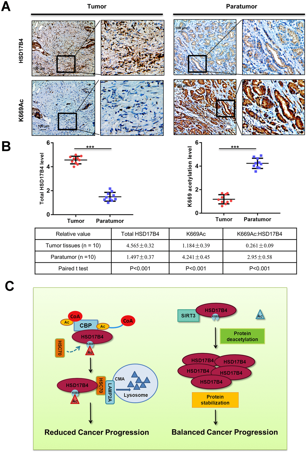 K669 acetylation is downregulated in human PCa samples. (A–B) Immunohistochemical staining of K669-acetylated and total HSD17B4 proteins in tumor and adjacent tissues. Examples are shown in (A), and the statistical analysis of all samples is shown in (B). Scale bars: 100 mm. The intensities of the K669-acetylated (left panel) and total (right panel) HSD17B4 protein were quantified, followed by statistical analysis. A total of 10 PCa tissues and 10 adjacent normal prostate tissues were analyzed. The mean value of multiple samples and the standard deviation are presented. (C) Working model. The increase in K669 acetylation promotes HSD17B4 degradation via CMA and then slows down the progression of PCa. CREBBP increases the HSD17B4 acetylation level and promotes its degradation, while SIRT3 can deacetylate K669 acetylation and stabilize its protein level. The accumulation of HSD17B4 can lead to consistent proliferation and migration of PCa cells. Data are shown as the mean ± SD (n = 3) or typical photographs of one representative experiment. Similar results were obtained in three independent experiments. *p 