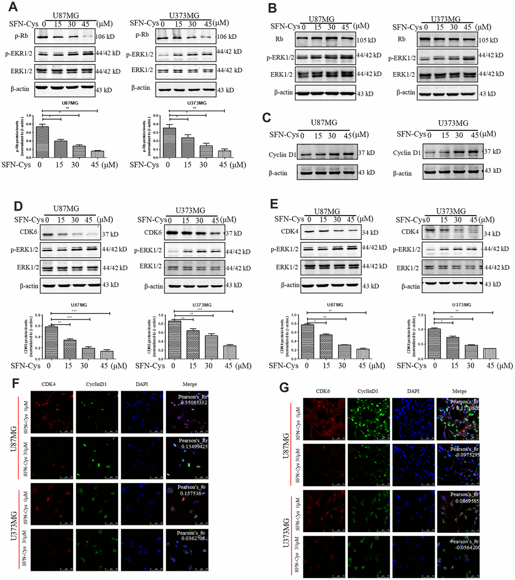 SFN-Cys decreased the expressions of p-Rb, CDK4 and CDK6; while increased the expressions of p-ERK1/2 and Cyclin D1, and decreased the co-localization of CDK4, CDK6 to Cyclin D1. (A–E): Western blot showed the expressions of p-Rb, Rb, CDK4, CDK6, p-ERK, and Cyclin D1 in both U87MG and U373MG cells treated with SFN-Cys at the indicated concentrations. (F, G) Immunofluorescence and confocal microscopy were employed to observe the co-localization of CDK4, CDK6 to Cyclin D1 in both U87MG and U373MG cells. Scale bar: 75 μm. Data were shown as means ± SD (n ≥ 3). *, P ≤ 0.01.