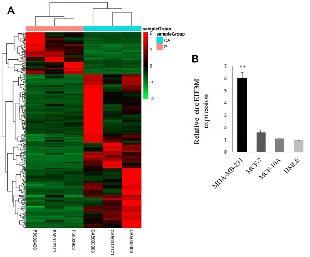 Overview of circRNA profiles (CA: TNBC tissues; P: normal breast tissues). (A) Hierarchical cluster analysis of differentially expressed circRNAs. The red and green colors indicate high and low expression, respectively. (B) Relative expression of circEIF3M in cell lines was determined by qRT-PCR. **P 