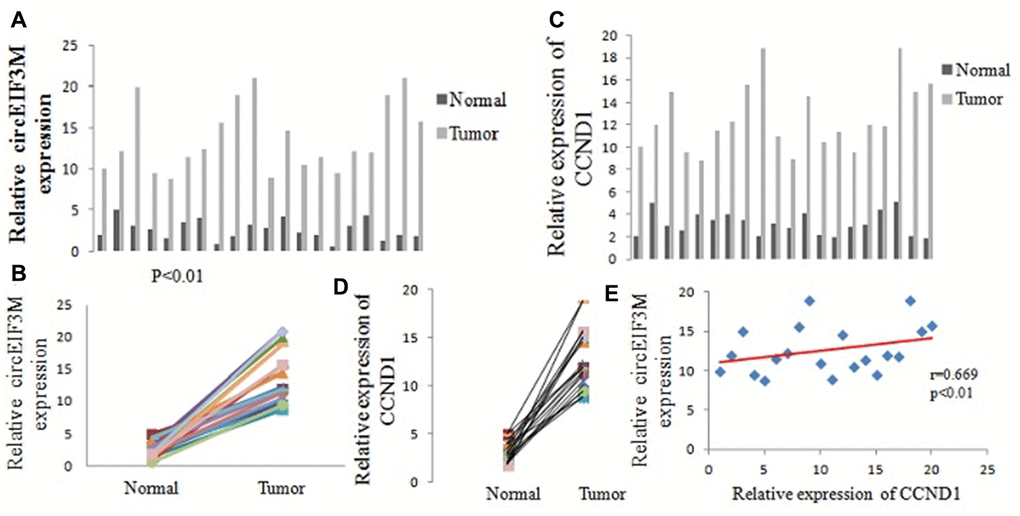 CircEIF3M and CCND1 are upregulated in TNBC. (A and B) Relative expression of circEIF3M in TNBC tissues (Tumor) and adjacent non-tumor tissues (Normal) was detected by qRT-PCR (n = 20). (C and D) Relative expression of CCND1 in TNBC tissues (Tumor) and adjacent non-tumor tissues (Normal) was detected by qRT-PCR (n =20). (E) Pearson correlation analysis of circEIF3M and CCND1 expression in 20 TNBC tissues. Data were showed as mean ± SD, P 