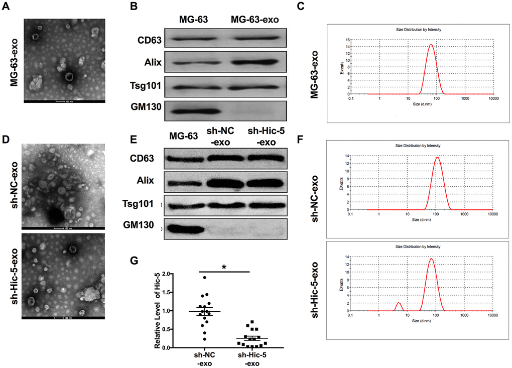 Exosomes derived from OS supernatant were identified. (A) The morphology of exosome was observed by TEM. (B) The biomarker (CD63, Alix, Tsg101 and GM130) of exosome were detected by western blot. (C) Exosome particle size (about 30-150 nm) were analyzed. The characteristics of sh-Hic-5-exo and sh-NC-exo were confirmed by TEM (D), biomarker (E) and particle size (F). (G) The mRNA expression of Hic-5 was measured in sh-Hic-5-exo and sh-NC-exo. n=4, *P