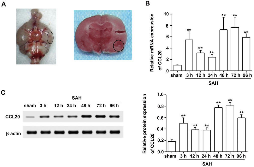 CCL20 expression was increased after SAH. (A) Representative picture of brains from the SAH groups and a schematic indicating the optimal brain region for further analyses (B) The CCL20 mRNA expression levels were determined by RT-qPCR (n = 5 per group). (C) The CCL20 protein expression levels were determined by Western blotting (n = 5 per group). Data were presented as mean ± SD. **P vs. the sham group.