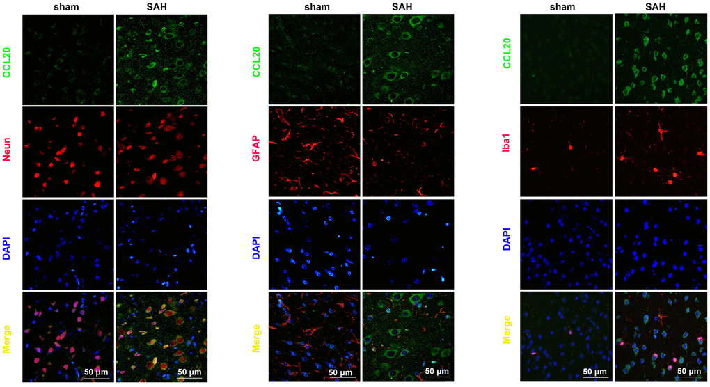 CCL20 was mainly localized in neurons and microglia. Double immunofluorescence staining was performed on mouse brain sections incubated with CCL20 (green) and NeuN (red), GFAP (red), or Iba1 (red). Cell nuclei were stained with DAPI (blue). Scale bar = 50 μm.