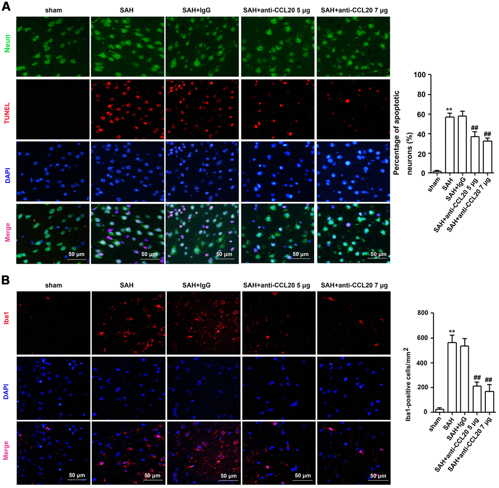 The effects of CCL20 on the neuronal apoptosis and microglial activation after SAH. (A) Neuronal apoptosis was determined by coimmunofluorescence staining for TUNEL (red), NeuN (green) and DAPI (blue) in the right temporal cerebral cortex at 24 h after SAH (n = 5 per group). Scale bar = 50 μm. (B) Microglial activation was detected through coimmunofluorescence staining for Iba1 (red) and DAPI (blue) in the cerebral cortical at 24 h after SAH (n = 5 per group). Scale bar = 50 μm. Data were presented as mean ± SD. **P vs. the sham group. ##P vs. the SAH+IgG group.