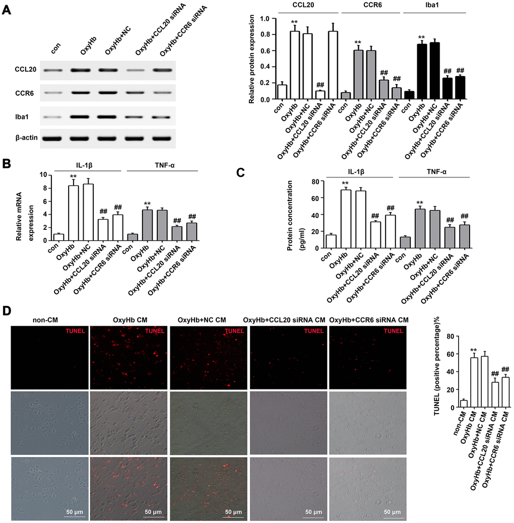 The CCL20/CCR6 axis in microglia is involved in microglial activation and microglia-mediated neuronal apoptosis in vitro. (A) Cultured microglia were transfected with the negative control siRNA (NC), CCL20 siRNA or CCR6 siRNA. After incubation for 72 h, microglia were exposed to OxyHb for 24 h. Next, Western blotting was used to measure the levels of CCL20, CCR6 and Iba1 (a microglial activation marker) (n = 3 per group). (B, C) The effects of CCL20 siRNA and CCR6 siRNA on OxyHb-induced IL-1β and TNF-α expression in microglia were analyzed by RT-qPCR (B) and ELISA (C) (n = 3 per group). (D) Cultured neurons were subjected to OxyHb-untreated conditioned medium (non-CM), OxyHb-treated conditioned medium (OxyHb CM), OxyHb CM from microglia pretreated with NC for 72 h (OxyHb+NC CM), OxyHb CM from microglia pretreated with CCL20 siRNA for 72 h (OxyHb+CCL20 siRNA CM), and OxyHb CM from microglia pretreated with CCR6 siRNA for 72 h (OxyHb+CCR6 siRNA CM) for 24 h. The apoptotic neurons were stained with TUNEL (red) (n = 3 per group). Scale bar = 50 μm. Data were presented as means ± SD. **P vs. the control group (con) or the non-CM group. Data were presented as mean ± SD. ##P vs. the OxyHb+NC group or the OxyHb+NC CM group.