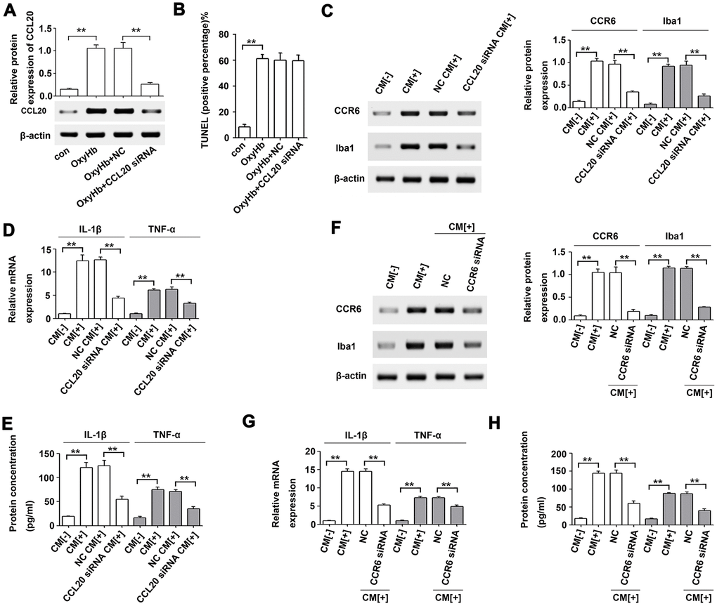 Microglial activation was induced by neuron-derived CCL20 in vitro. (A) The effect of CCL20 siRNA on OxyHb-induced CCL20 expression was analyzed by Western blotting (n = 3 per group). (B) The effect of CCL20 on OxyHb-induced neuronal apoptosis was analyzed by TUNEL assay (n = 3 per group). (C–E) Cultured microglia were subjected to OxyHb-untreated conditioned medium (CM[-]), OxyHb-treated conditioned medium (CM[+]), and OxyHb CM from neurons pretreated with CCL20 siRNA for 72 h (CCL20 siRNA CM[+]) for 24 h. Western blotting (C) was used to determine CCR6 and Iba1 levels (n = 3). The IL-1β and TNF-α expression levels were analyzed by RT-qPCR (D) and ELISA (E) (n = 3 per group). **PF–H) Cultured microglia pretreated with NC and CCR6 siRNA for 72 h were exposed to CM[+]. Then, Western blotting (F) was used to determine CCR6 and Iba1 levels (n = 3). RT-qPCR (G) and ELISA (H) were used to determine IL-1β and TNF-α levels (n = 3 per group). Data were presented as means ± SD. **P 