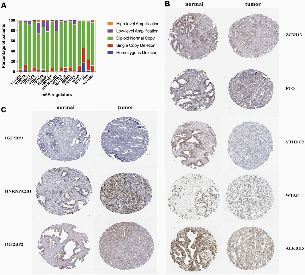 CNV distribution and protein level of m6A methylation regulatory genes in TCGA-PRAD. (A) distribution of different CNV patterns; (B, C) Immunohistochemistry images of m6A regulators from the human protein atlas database.