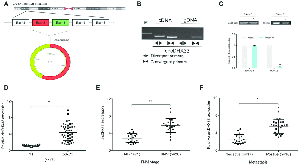 circDHX33 was highly expressed in ccRCC. (A) Schematic diagram of circDHX33. (B) Random hexamer or oligo (dT)18 primers were used in the reverse transcription experiments. (C) The relative RNA levels were determined by qRT-PCR. (D) The expression of circDHX33 in 47 paired ccRCC tissues was detected by qRT-PCR. (E, F) High circDHX33 expression was linked to advanced TNM stage and metastasis in ccRCC patients. *pp