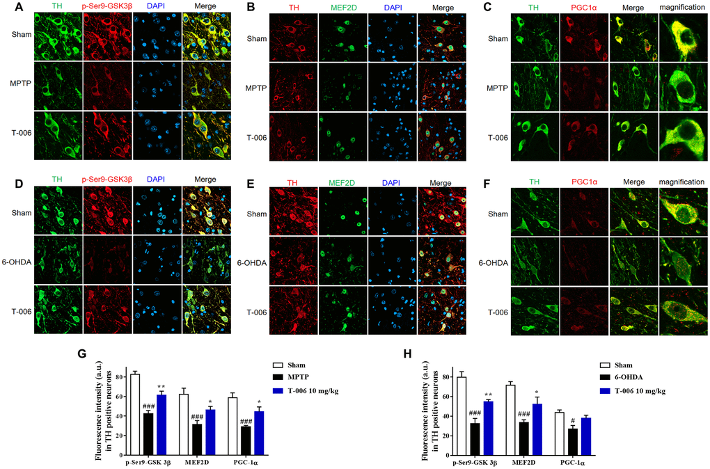 T-006 prevents the loss of SN DA neuron loss by activating MEF2D/PGC1α/GSK3β signal pathway. Representative images of middle brain sections co-stained with antibodies against (A, D) TH (green) and p-GSK3β (red); (B, E) TH (red) and MEF2D (green); (C, F) TH (green) and PGC1α (red). DAPI (blue) indicates nucleus. (G, H) Quantitative analysis of immunofluorescence intensity in TH-positive cells. Data are expressed as mean±SEM (n=3 to 4 per group). #P###P*P**P+ or 6-OHDA group.