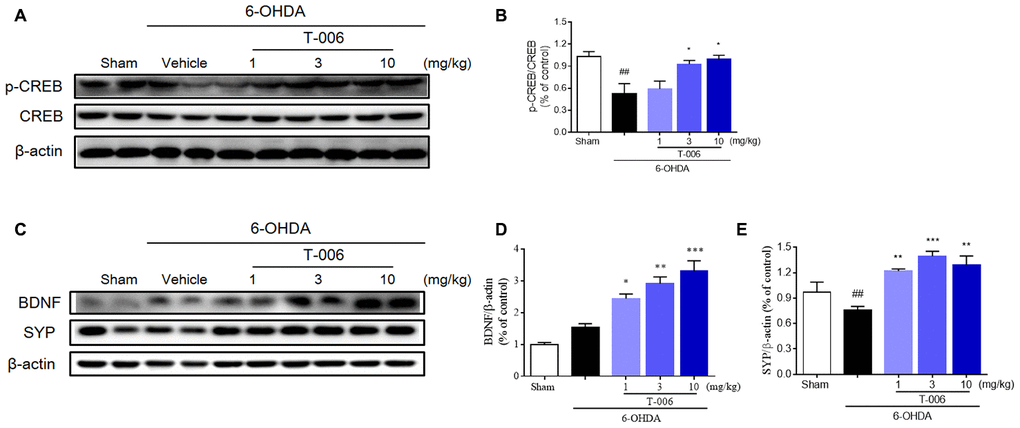 T-006 activates BDNF/CREB signaling pathway to provide neuro-repair in PD rats. Representative immunoblotting (A, C) and quantification of the relative protein level of p-CREB/CREB (B), BDNF (D) and synaptophysin (SYP, E) in the brain infarct region of sham, vehicle or T-006-treatment rats in 6-OHDA-induced PD rats. Data are expressed as mean±SEM (n=3 to 4 per group). ##P*P**P***P