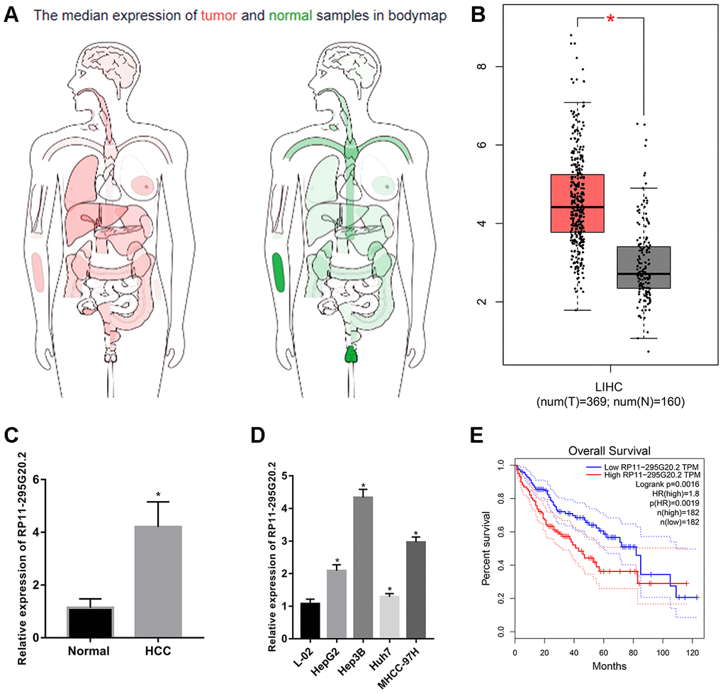 RP11-295G20.2 is highly expressed in HCC tissues and cell lines. (A) The expression profile of RP11-295G20.2 in various cancers by analysing TCGA database using GEPIA. (B) The expression level of RP11-295G20.2 in HCC by analysing GEPIA, *P C) RT-qPCR results of RP11-295G20.2 expression in HCC tissues (n=30) and paracancerous tissues(n=30), *P D) RP11-295G20.2 expression in HCC cell lines was detected using RT-qPCR, *P E) Kaplan-Meier analysis of the correlation between RP11-295G20.2 expression and overall survival (OS) in patients with HCC using GEPIA.