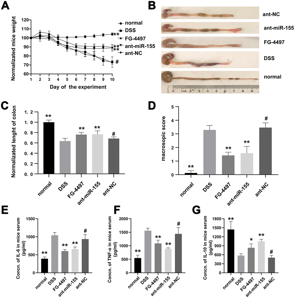 MiR-155 contributed to DSS-induced colitis in mice. (A) Normalized weights of mice were presented. (B) Colons gross appearances from each group were showed. (C) Colonic lengths were measured. (D) Macroscopic score of each group colonic tissue was presented. (E–G) IL-6, TNF-α, and IL-10 in mice serum were measured with ELISA. Each bar represents mean ± SD, n=8 from each group. #P > 0.05, *P 