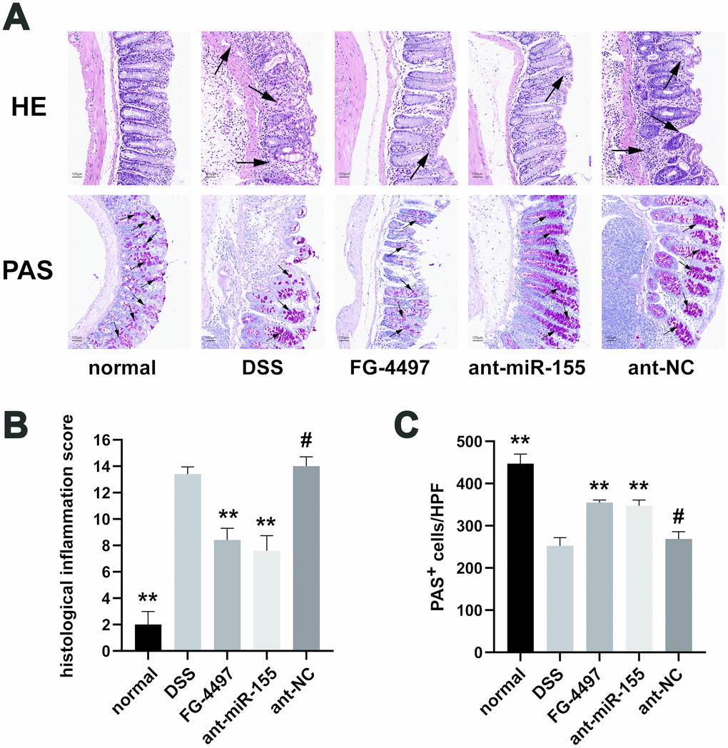 Histopathological evaluation of intestinal inflammation in all groups. (A) Hematoxylin and eosin (HE) and Periodic Acid-Schiff (PAS) analysis of colon specimens (magnification ×100). Massive inflammation cell infiltration, mucosal erosion, and submucosa edema were observed throughout the colons in the DSS and ant-NC group. For PAS stain, red particles marked by black arrows represented the positive change. (B) Histological inflammation scores in all groups were presented. (C) PAS+ cells per high power field in all groups were presented. Each bar represents mean ± SD, n=5 from each group. #P > 0.05, *P 