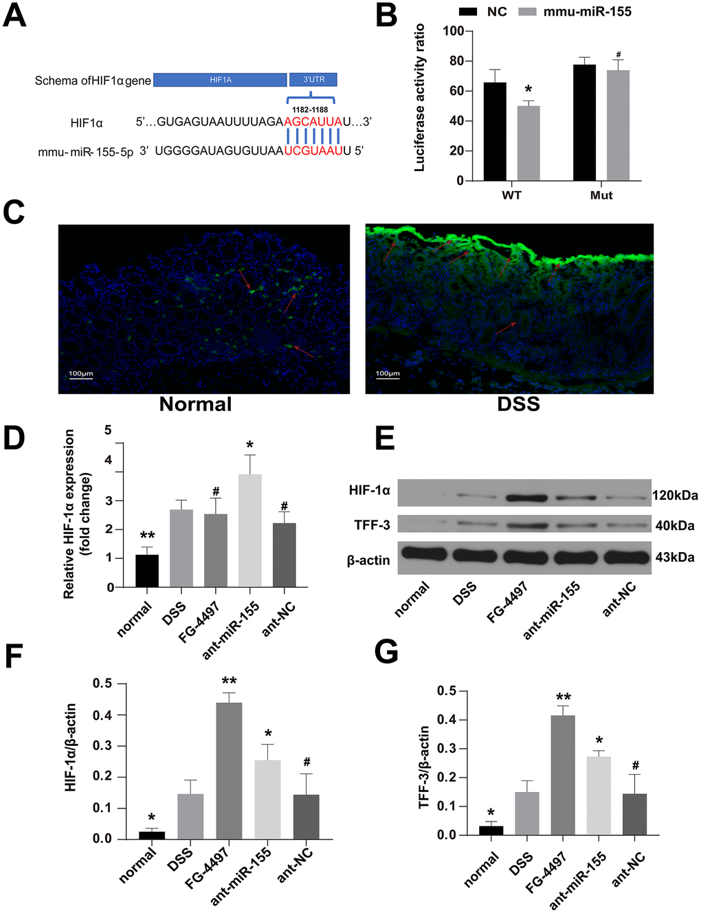MiR-155 dilapidated intestinal barrier may by targeting HIF-1α/TFF-3 axis. (A) Wild-type sequences of HIF-1α for miR-155 target. (B) Dual luciferase report assay of HIF-1α 3’-UTR wild type or MUT along with miR-155. #P > 0.05, *P C) The hypoxic station in normal and DSS-induced colitis mice colon labeled by hypoxia Probes. Green was the positive signal. (magnification ×100). (D) Relative mRNA of HIF-1α in mice colonic tissue were measured by qPCR (n=5). (E) Western blotting analysis of HIF-1α proteins and TFF-3 proteins in mice colon. (F, G) Representative protein levels of TFF-3/β-actin and HIF-1α/β-actin(n=3). Each bar represents mean ± SD. #P > 0.05, *P 