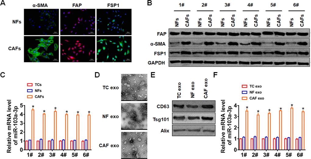 CAFs secreted exosomal miR-103a-3p in NSCLC. (A) Immunofluorescence staining and (B) Western blot for α-SMA, FAP, and FSP1 expression of NFs and CAFs. (C) qRT-PCR analyzed the expression of miR-103a-3p in TCs, NFs and CAFs. (D) TEM of exosomes isolated from TCs, NFs and CAFs. (E) The expression of CD63, Alix, and Tsg101 in exosomes was detected by western blot. (F) The expression of miR-103a-3p in exosomes form TCs, NFs and CAFs was tested by qRT-PCR. *p