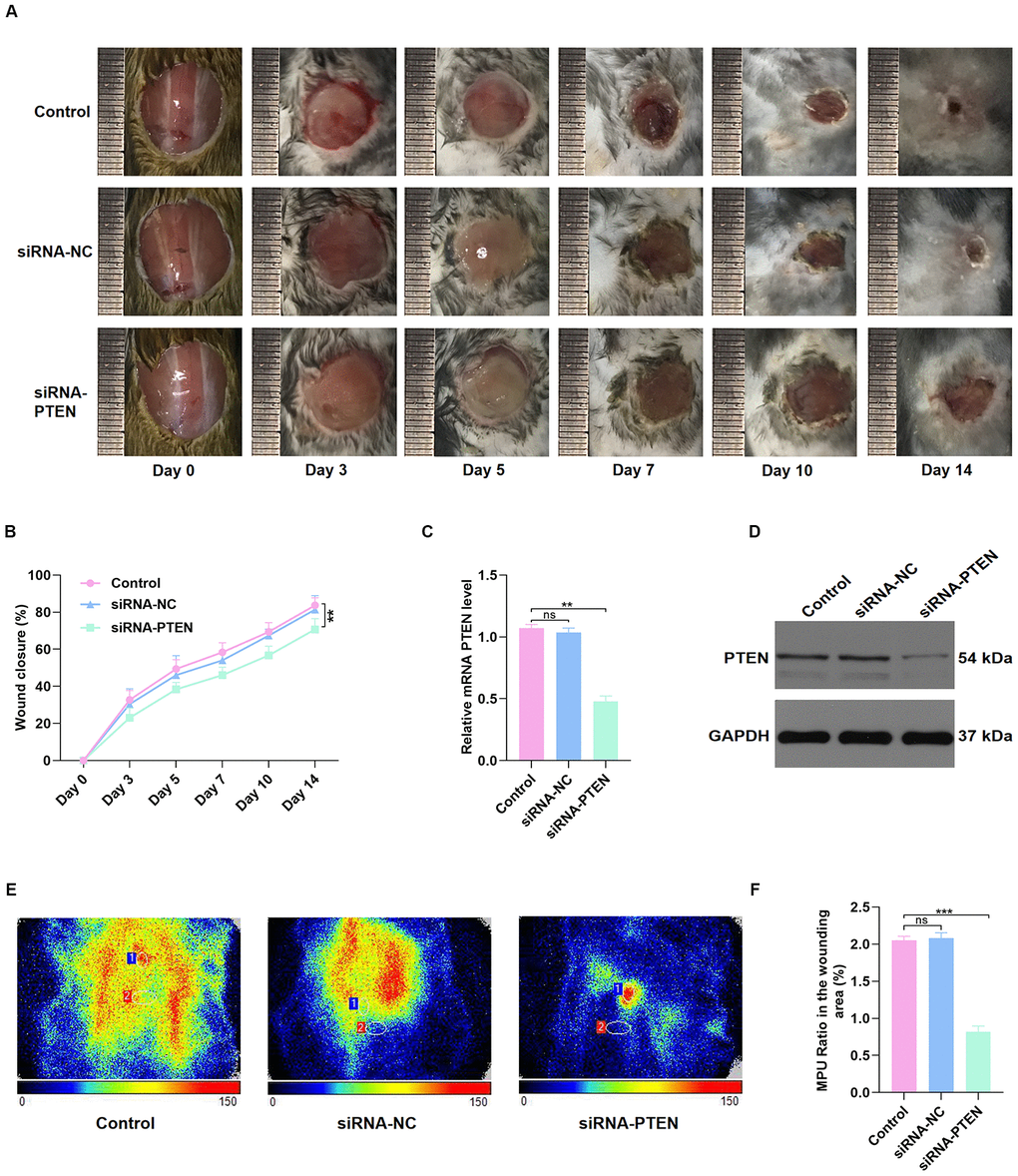 PTEN inhibition delayed wound healing in vivo. (A–B) The general view of wound repair in the mice models. (C–D) PTEN expression of skin tissue in the wound area was measured by qRT-PCR and WB analyses. (E–F) Doppler results of blood perfusion in the wound area among the three groups. Data are the mean ± SD of three independent experiments. *P 