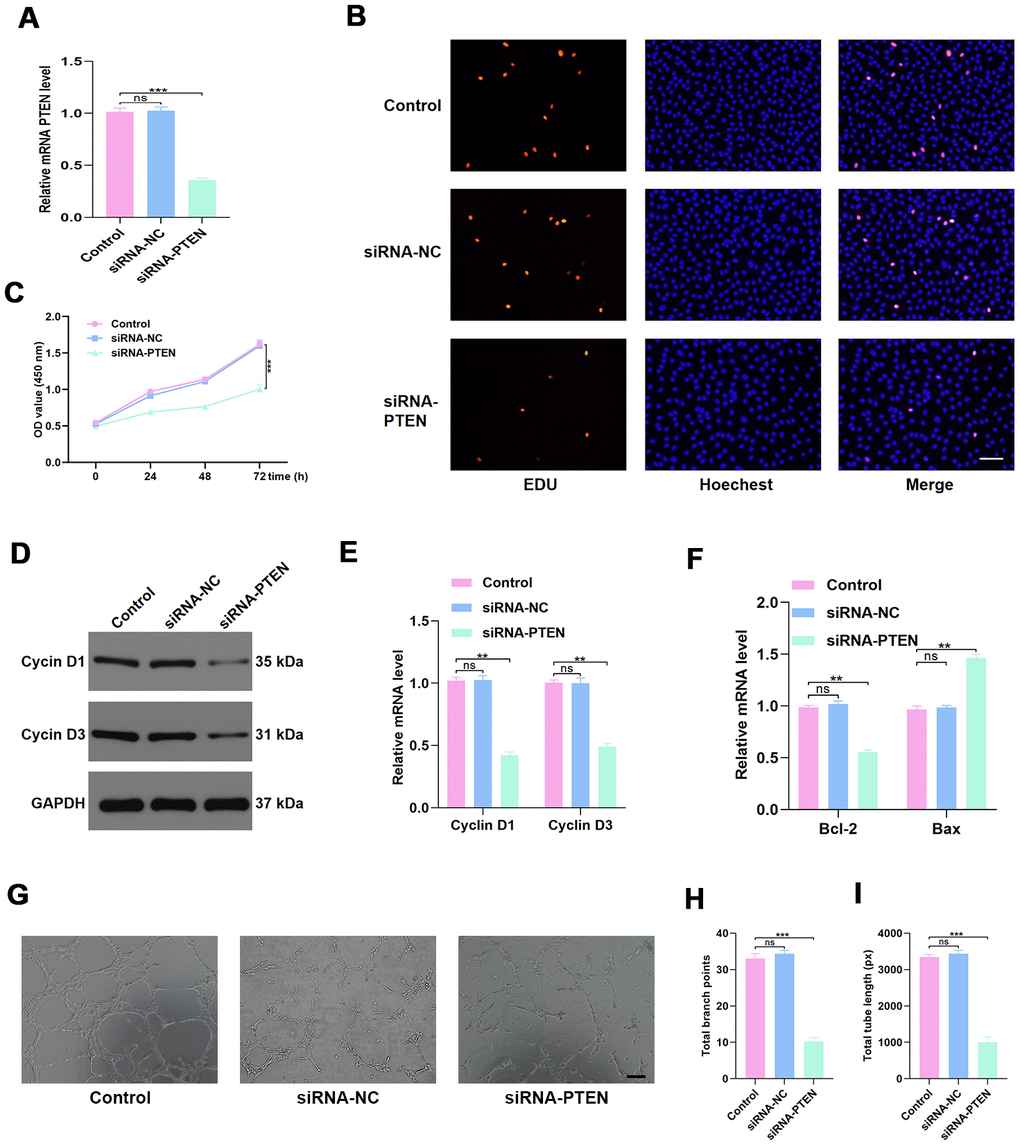 PTEN regulates HUVEC function. (A) PTEN expression was measured by qRT-PCR in the different treated groups. (B–C) Effect of diabetic exosomes on HUVEC proliferation measured by CCK8 and EDU incorporation assays. Scale bar: 100 μm. (D–E) The effect of PTEN on the levels of the proliferation-related proteins Cyclin D1 and Cyclin D3, assessed by WB and qRT-PCR analysis. (F) The effect of PTEN on the levels of the apoptosis-related proteins Bax and Bcl-2. (G–I) Effects of PTEN on tube formation ability of HUVECs. Scale bar: 200 μm. Data are the mean ± SD of three independent experiments. *P 