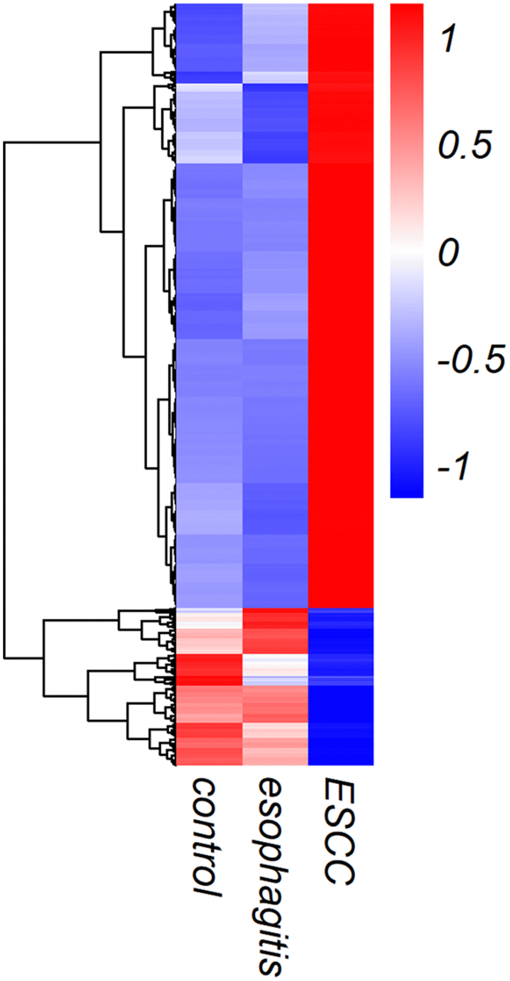 Heat map showing lncRNA expression in exosomes from ESCC patients, esophagitis patients, and healthy controls.