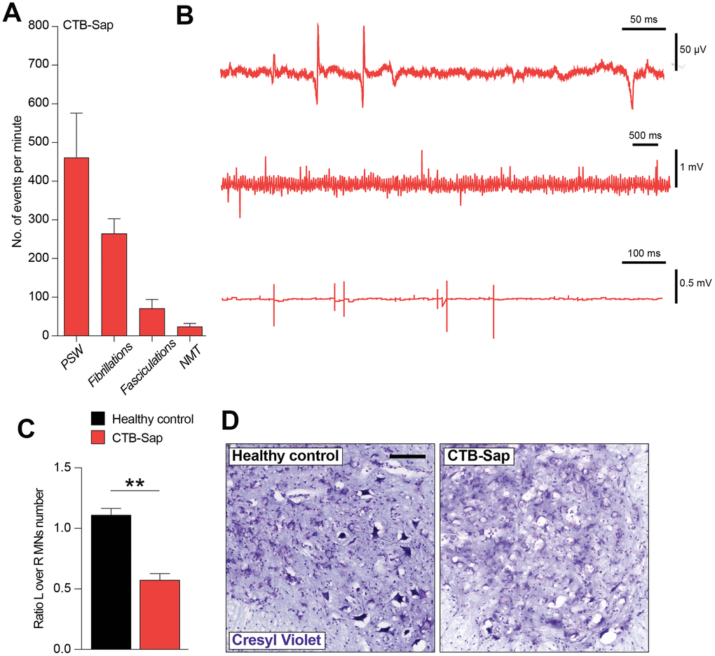 Electromyographic signs and neuropathological analysis of CTB-Sap lesioned mice. Quantification (A) and representative profile of electromyographic activity of gastrocnemius muscle in CTB-Sap lesioned mice. (B) positive sharp waves (PSW), fibrillations, fasciculation and neuromyotonia (NMT); data in (A) are expressed as mean events per minute ± SEM. (C) Quantification of the number of neurons in left (L) over right (R) ventral horn of CTB-Sap lesioned mice versus healthy control; data are expressed as mean ratio L over R ± SEM; **p-value D) Representative images of cresyl violet stained motoneurons in left Rexed lamina IX of healthy control and CTB-Sap lesioned mice. Scale bar: 100 μm. MNs: motoneurons.