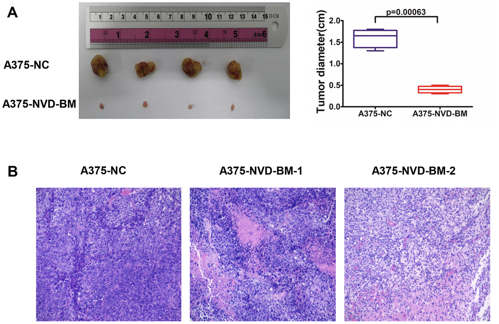 NVD-BM inhibits melanoma proliferation in xenograft mice. (A) Subcutaneous tumors generated in BALB/c-nu/nu mice, with NVD-BM transduced A375 cells. A375 cells transduced with blank lentiviral vector, and vectors expressing pCDH and NVD-BM were collected and subcutaneously injected into BALB/c-nu/nu mice, at a cell density of 1×107 to elicit tumorigenicity. Tumors were removed and diameters measured (n = 4/group) ± standard deviation (SD). (B) Hematoxylin eosin (HE) tumor staining in transduced A375 cells. Nuclei are blue. Cytoplasm is red. Magnification × 200.