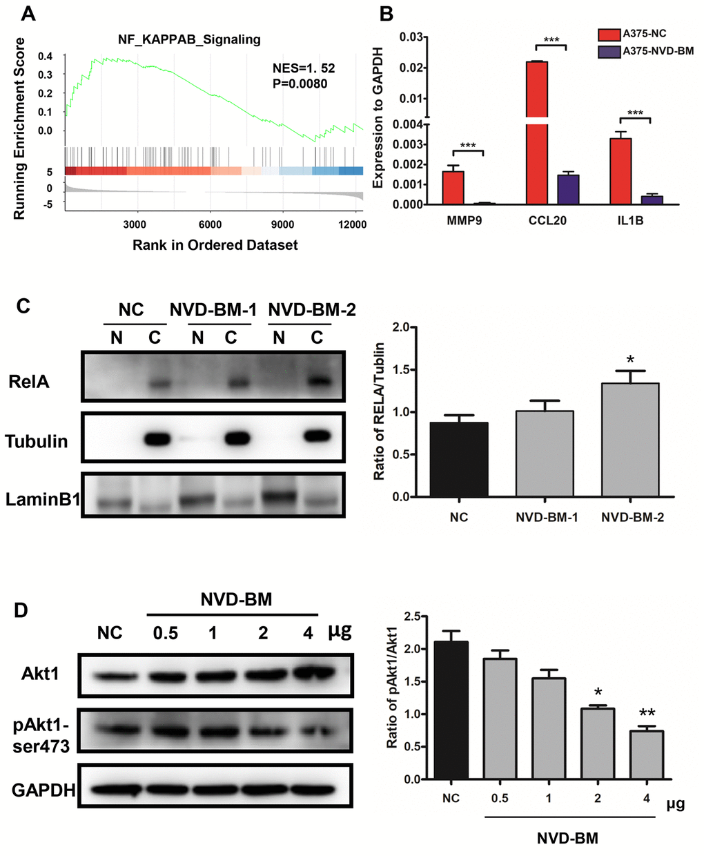 NVD-BM functions as a tumor suppressor via Akt1/NF-κB signaling. (A) GSEA revealed up-regulated genes associated with NF-κB signaling in melanoma (GSE3189 dataset). (B) Gene expression of the NF-κB target genes, MMP9, CCL20 and IL1B relative to GAPDH, in A375 cells transfected with NVD-BM, when compared with A375 cells transfected with blank vector, pCDH. (C) Western blot of A375 cells transfected with two different plasmid NVD-BM concentrations, when compared with pCDH blank vectors, analyzing the entry of RELA into the nucleus. (D) Western blot of A375 cells transfected with two different plasmid NVD-BM concentrations, when compared to the pCDH blank vector analyzed phosphorylated and unphosphorylated Akt1-SER473 with normalization to GAPDH. (*p 