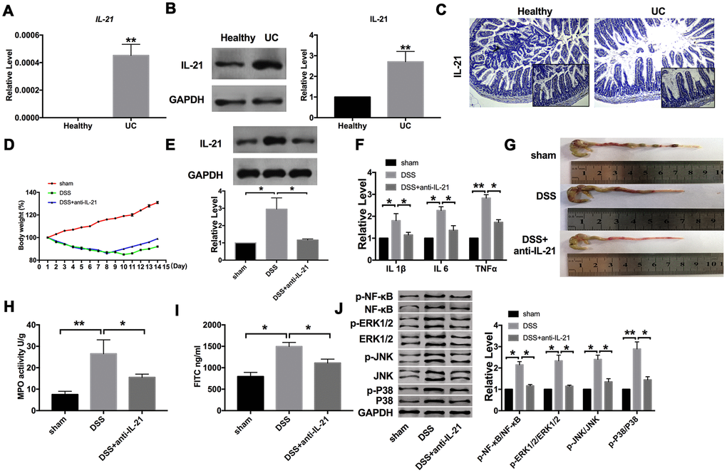 Increased expression of IL-21 in UC patients. (A) The expression of IL-21 in colonic mucosa from UC patients and healthy volunteers. n=15. (B) The protein level of IL-21in human samples. n=5. (C) Representative images of immunohistochemistry staining with IL-21. (D) Changes in body weight in different groups of mice. n=10. (E) The protein level of IL-21 in different groups. n=10. (F) The mRNA level of IL1β, IL6, and TNFα in plasma. n=5. (G) The length of the colon in different groups of mice. (H) MPO activity detection in different groups of mice.n=5. (I) Serum FITC- dextran was used as a monitoring index of intestinal permeability. n=6. (J) The protein level of NF-κB/MAPKs/JNK signaling pathway components in different groups. n=5 *P .