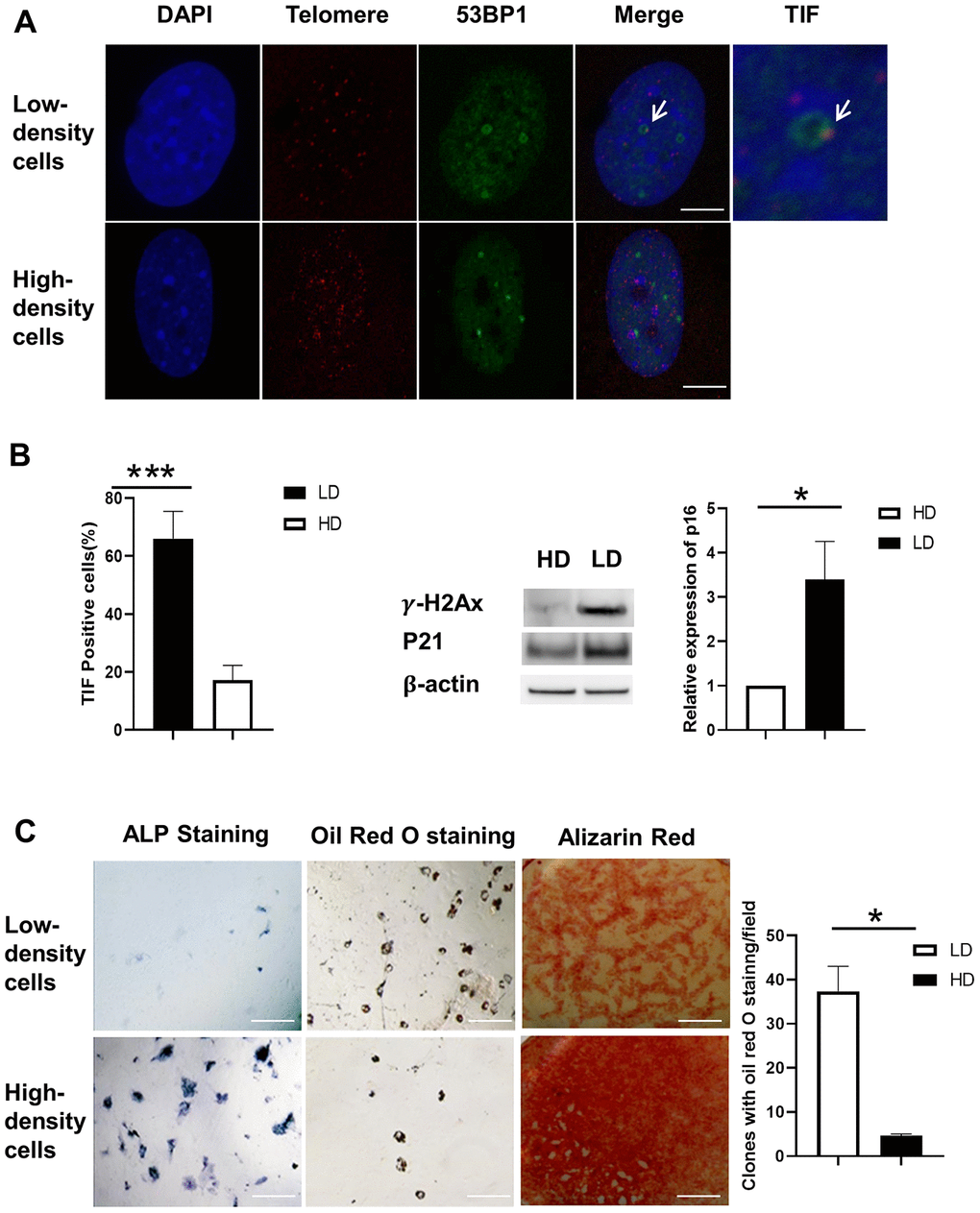 Differentiation capacity and TIF assay of BMSCs after separation. (A) Co-localization of 53BP1 DNA damage protein (green) and telomeric DNA (red). TIFs are indicated by arrows. Blue, DAPI; Red, Telomere; Orange/Yellow, TIFs. Scale Bar=5μm. (B) The percentage of TIF-positive cells is substantially lower in high-density cells compared to low-density cells (left panel). The protein levels of γH2AX and P21 were induced at low density (LD) using Western blot. P16 gene expression was increased at LD using real-time PCR. (C) Low- and high-density cells were cultured either in osteogenic induction medium or adipogenic induction medium for 7 days. ALP and oil red O staining were conducted at the end of 14 days. ALP staining (upper- and lower-left panels) was induced in the high-density cell group. Oil red O staining (upper- and lower-middle panels) was induced in the low-density cell group. Alizarin red staining (upper- and lower-right panels) was induced in the high-density cell group. Quantification of clones of oil red O staining positive (n=3) is shown in the graph at right. ALP indicates alkaline phosphatase; DAPI, 4′,6-diamidino-2-phenylindole; HD, high density; LD, low density; TIF, telomere dysfunction-induced foci. Paired T-Test, ***, P