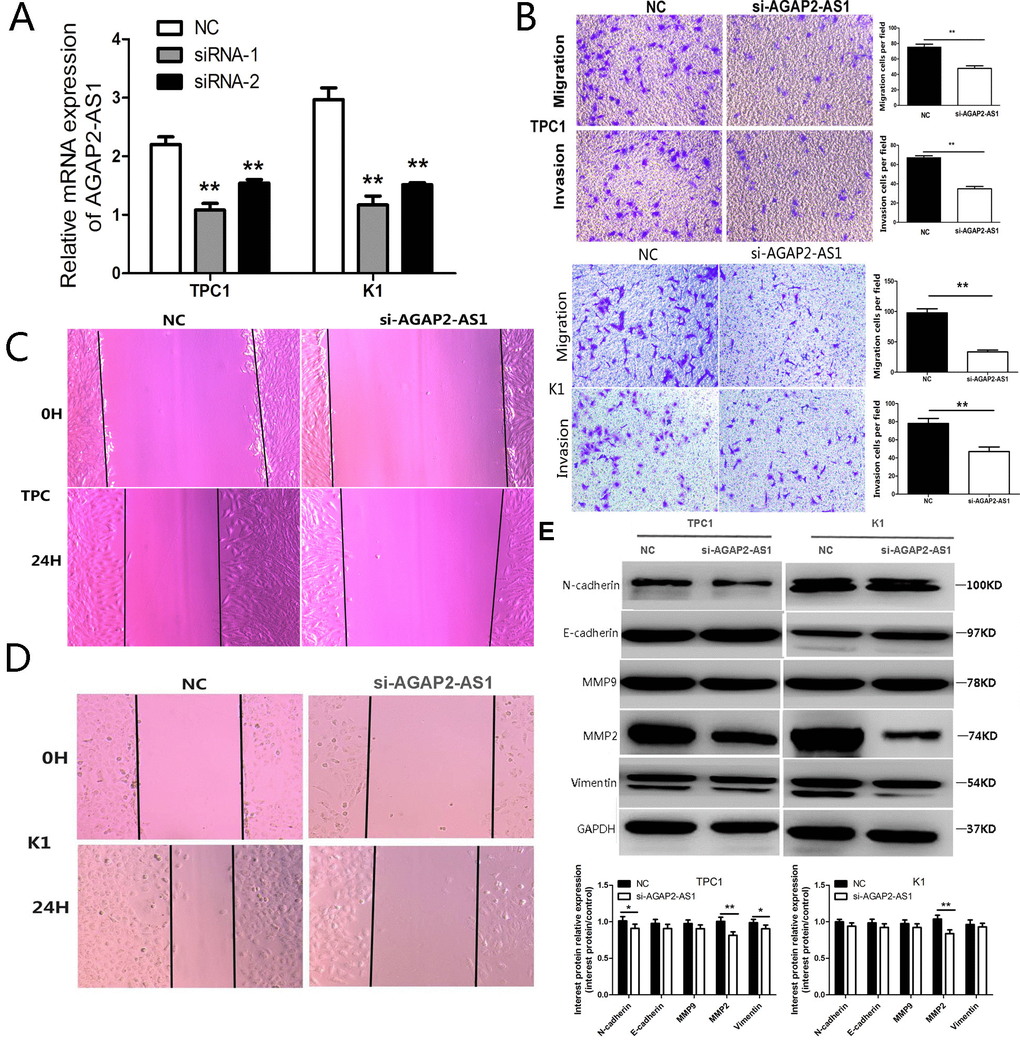 Knockdown of AGAP2-AS1 inhibits invasion and migration in PTC cells. (A) RT-PCR of AGAP2-AS1 after si-RNA suppression in PTC cells; **P vs. NC. (B) Transwell assay in PTC cells after transfection with si-AGAP2-AS1 or NC. Data are presented as the mean ± SD, analyzed using independent samples t-test. **P vs. NC. (C, D) Wound healing assay in PTC cells after transfection with si-AGAP2-AS1 or NC. E. Western analysis of N-cadherin, E-cadherin, MMP2, MMP9, and Vimentin after transfection with si-AGAP2-AS1 or NC in PTC cells; **P vs. NC.