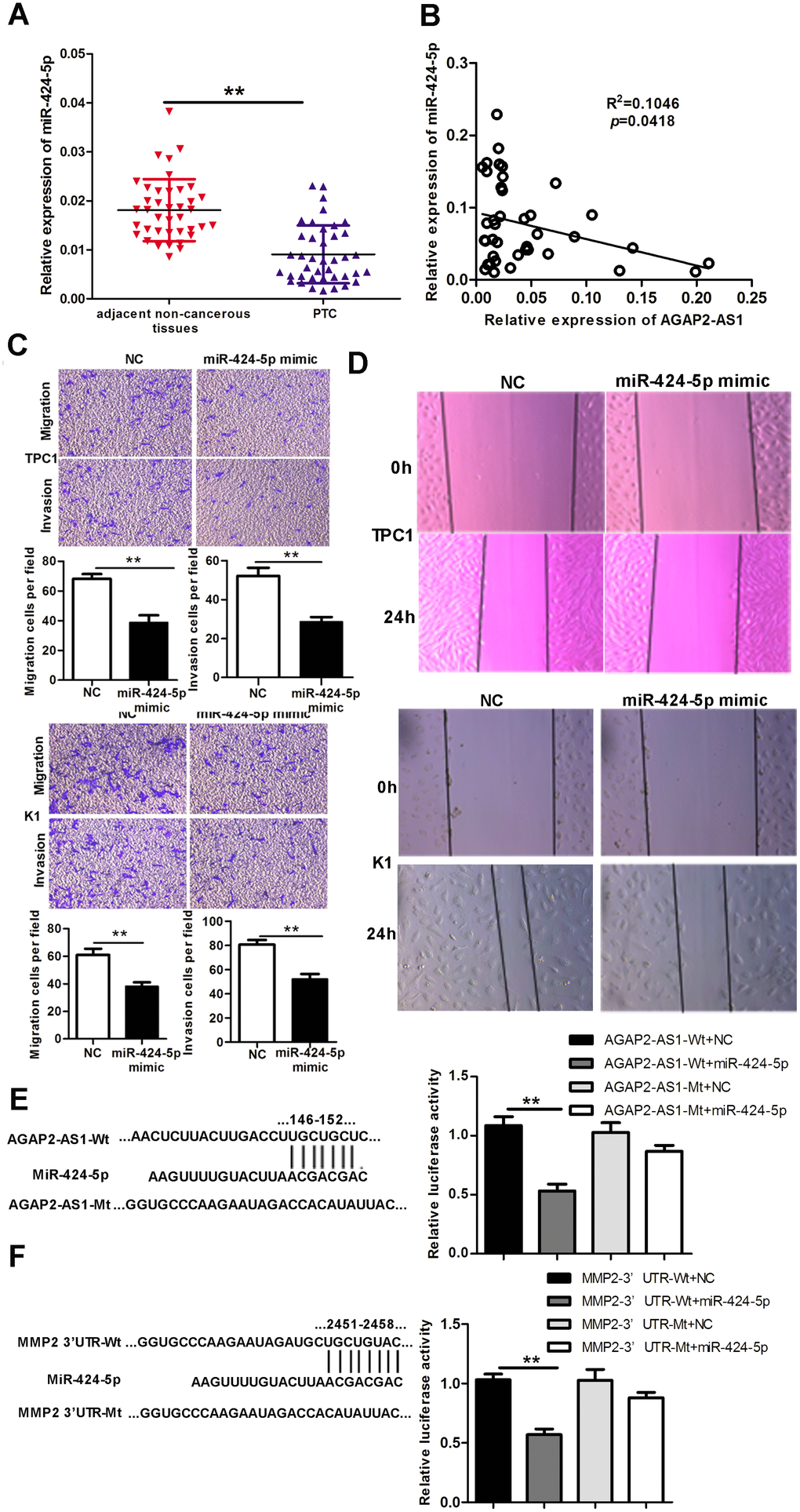 MiR-424-5p is downregulated in PTC tissues, binds to AGAP2-AS1 and MMP2, and regulates invasion and migration of PTC. (A) Expression of miR-424-5p in 40 pairs of PTC tissues and paired non-cancerous tissues, assessed using qRT-PCR. The Wilcoxon signed-rank test was used to analyze the differences between the two groups; data are presented as the median with a range. **P B) Pearson’s correlation analysis between AGAP2-AS1 and miR-424-5p expression in PTC tissues (R2 = 0.1046, p = 0.0418). (C) Trans-well assay of invasion and migration of PTC cells after transfection with miR-424-5p mimic or NC. Data are presented as the mean ± S.D, analyzed using an independent samples t-test. **P vs. NC. (D) Wound healing assay to assess the migration ability of PTC cells after transfection with miR-424-5p mimic or NC. (E) Predicted miR-424-5p binding sites in AGAP2-AS1 (AGAP2-AS1-Wt) and the designed mutant sequence (AGAP2-AS1-Mt) are indicated. HEK 293T cells were transfected with AGAP2-AS1-Wt, AGAP2-AS1-Mt, and the indicated miRNAs, and luciferase reporter assay was conducted. Data are presented as the mean ± S.D, analyzed using an independent samples t-test; **P vs. AGAP2-AS1-Wt + NC. (F) Predicted miR-424-5p binding sites in the 3′-UTR region of MMP2 (MMP2-3′UTR-Wt) and the designed mutant sequence (MMP2-3′UTR-Mt) are indicated. HEK 293T cells were transfected with MMP2-3′UTR-Wt or ATAD2-3′UTR-Mt and the indicated miRNAs, and luciferase reporter assay was conducted. Data are presented as the mean ± S.D., analyzed using independent samples t-test. **P vs. MMP2-3′UTR-Wt + NC.