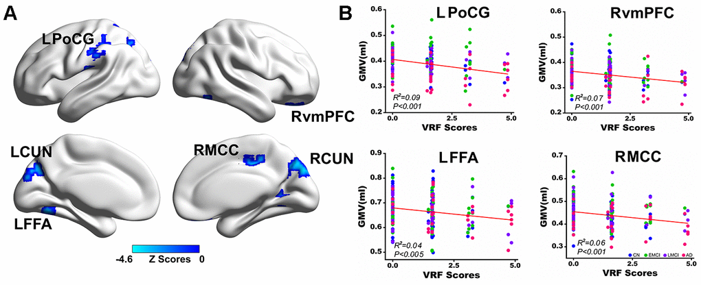 Multivariate regression analysis indicates the effects of VRFs on gray matter volume across all subjects. (A) Brain regions representing the significant effects of VRFs on GMV after controlling for the effects of covariates, including age, gender, APOEε4 genotype, and group. The blue color indicates a negative correlation between VRF scores and GMV. The color bar is presented with z scores. (B) Representative illustration of the significant effects of VRFs on regions of the LPoCG, LFFA, RvmPFC and RMCC. Abbreviations: VRFs, vascular risk factors; LPoCG, left postcentral gyrus; CUN, cuneus; LFFA, left fusiform face area; RvmPFC, right ventromedial prefrontal cortex; RMCC, right middle cingulate cortex; GMV, gray matter volume; CN, cognitively normal; EMCI, early mild cognitive impairment; LMCI, late mild cognitive impairment; AD, Alzheimer’s disease; APOE, apolipoprotein E.