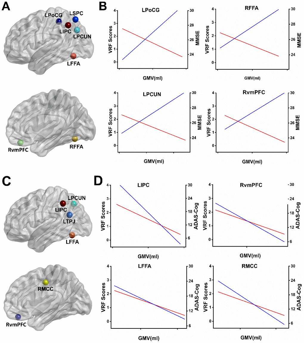 Overlapping regions from the effects of VRFs on GMV and the correlates of cognitive performance influenced by GMV. (A) Mapping the overlapping regions from the accumulating effects of VRFs on GMV and the neural correlates of the MMSE on GMV in the AD spectrum. (B) Representative illustration of the relationship among the VRF scores, GMV, and MMSE scores in the overlapped regions. The results indicate that higher VRF scores are associated with more GM atrophy (red lines) and a lower MMSE performance (blue lines). (C) Mapping the overlapped regions from the accumulating effects of VRFs on GMV and the neural correlates of the ADAS-Cog on GMV in the AD spectrum. (D) Representative illustration of the relationship among the VRF scores, GMV, and ADAS-Cog scores in the overlapped regions. The results indicate that higher VRF scores are associated with more GM atrophy (red lines) and a higher ADAS-Cog performance (blue lines). Abbreviations: LSPC, left superior parietal cortex; LPoCG, left postcentral gyrus; LIPC, left inferior parietal cortex; LPCUN, left precuneus; LFFA, left fusiform face area; RvmPFC, right ventromedial prefrontal cortex; RFFA, right fusiform face area; LTPJ, left temporoparietal junction; RMCC, right middle cingulate cortex; MMSE, Mini-Mental State Examination; ADAS-Cog, Alzheimer's Disease Assessment Scale-Cognitive Subscale; GMV, gray matter volume; VRF scores, vascular risk factor scores.
