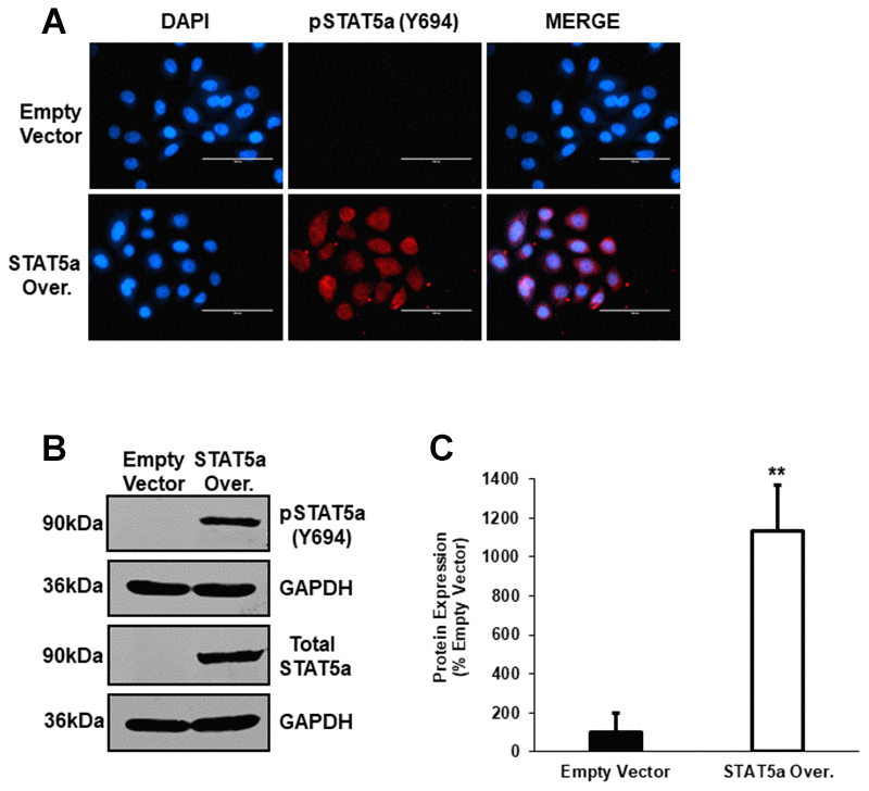 Western blot analysis following lentiviral-mediated overexpression of STAT5a in human MCF10DCIS.com. (A) Immunofluorescence staining was used to confirm overexpression of phosphorylated STAT5a (Y694) in MCF10DCIS.com cells. Empty vector and STAT5a overexpressor cells were immunostained with an antibody recognizing phosphorylated STAT5a (Y694). DAPI was used as a nuclear counterstain. The EVOS FL microscope was used to capture images at 40x objective with the DAPI and Texas Red light cubes (blue: DAPI immunostaining; red: phosphorylated STAT5a (Y694) immunostaining). Qualitatively, phosphorylated STAT5a (Y694) expression was upregulated in STAT5a overexpressor cells compared to empty vector control cells. Immunofluorescence was performed in triplicate on cells derived from 3 independent passages. (B) Western blotting was used to confirm overexpression of phosphorylated STAT5a (Y694) in MCF10DCIS.com cells. Whole cell lysates (100μg) of empty vector and STAT5a overexpressor cells were used to assess the protein expression of phosphorylated STAT5a (Y694) and total STAT5a. GAPDH was used as a control for equal loading. Western blotting was performed in triplicate on cells derived from 3 independent passages. (C) Densitometry analysis was performed using the LI-COR imager. A ratio of phosphorylated STAT5a (Y694) to total STAT5a was calculated upon normalizing to respective loading controls. Data are reported as % empty vector. Quantitatively, phosphorylated STAT5a (Y694) expression was upregulated in MCF10DCIS.com STAT5a overexpressor cells compared to empty vector control cells (11.3-fold, p