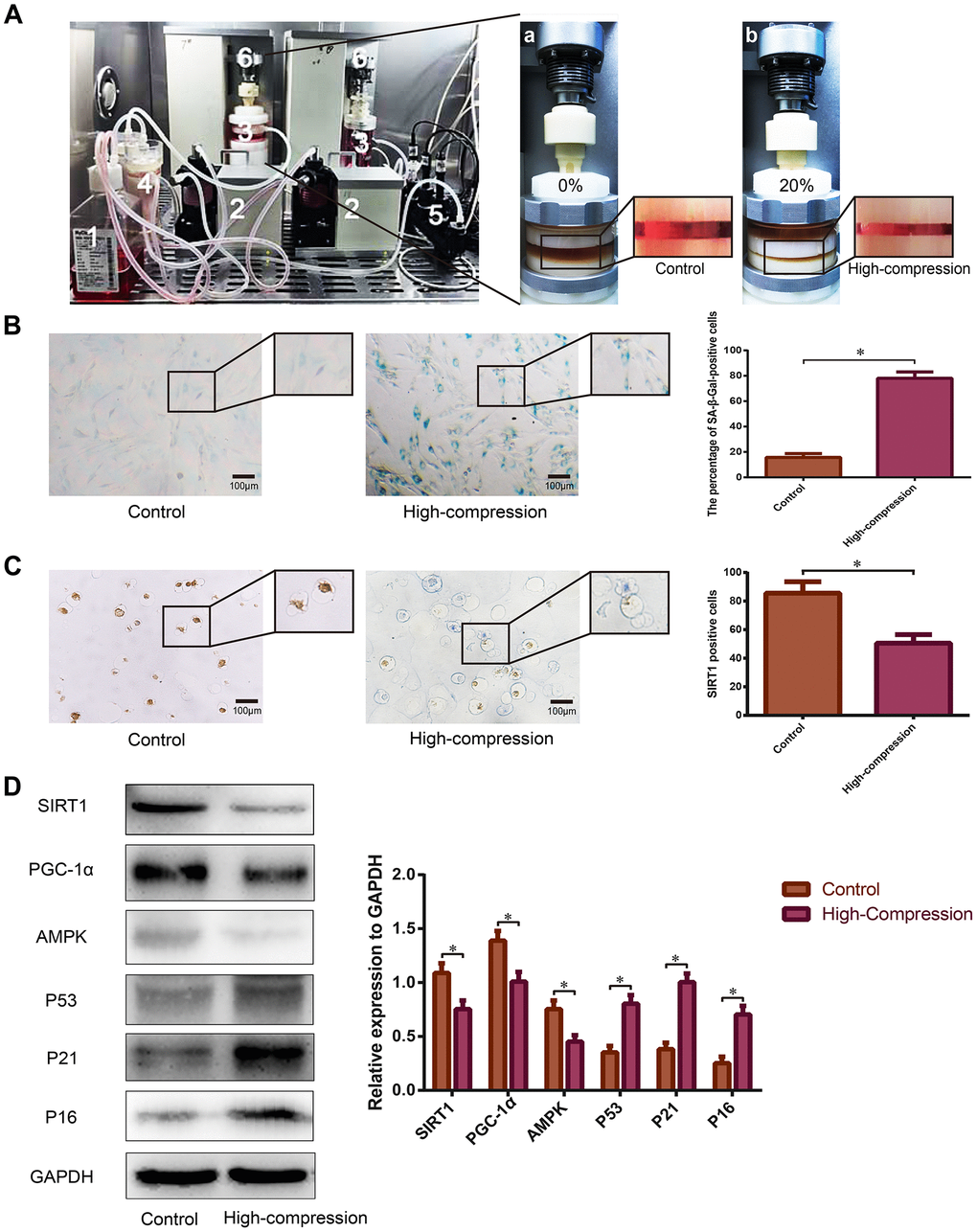 Analysis of SIRT1 expression and the degree of senescence in human NP cells subjected to high-magnitude compression. (A) Schematic of the primary units of the substance exchanger-based perfusion bioreactor system: (1) medium reservoir; (2) peristaltic pumps; (3) tissue culture chambers; (4) substance exchanger; (5) pH, PO2 and PCO2 sensor; (6) loading application devices. NP cell-encapsulated Gel-MA hydrogels were dynamically compressed by the loading application devices in the chambers at 0% (a) and 20% (b) compressive deformation for the control and high-compression groups, respectively at a frequency of 1.0 Hz. (B) The degree of senescence of the NP cells subjected to 0% or 20% (high-magnitude) compressive deformation was analyzed using SA-β-Gal staining (200×). (C) The expression level of SIRT1 in the NP cell-encapsulated hydrogels was detected by immunohistochemistry (200×). (D) The SIRT1, PGC1α and senescence-related protein (AMPK, P53, P21 and P16) levels were analyzed by Western blotting. *P