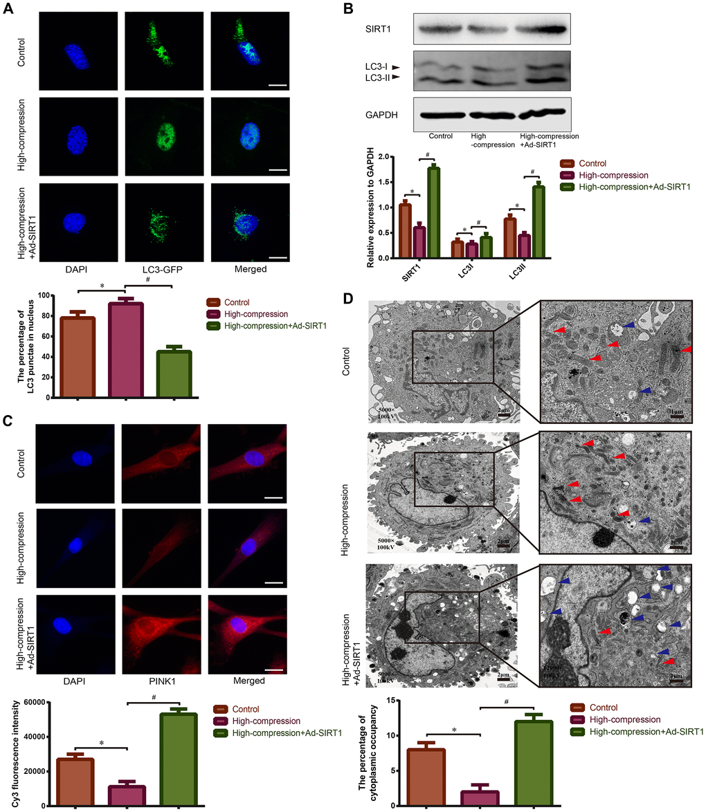 Observation of mitophagy in human NP cells with or without Ad-SIRT1 treatment under high-magnitude compression. (A) The distribution of GFP-LC3 puncta in NP cells subjected to high-compression or high-compression plus Ad-SIRT1 treatment was visualized by confocal microscopy (400×) after transfection of GFP-LC3-expressing adenovirus. (B) The relative expression levels of SIRT1 and LC3II/I in NP cells subject to high-compression or high-compression plus Ad-SIRT1 treatment were analyzed by Western blotting. (C) The expression of the key mitophagic regulator PINK1 was observed and analyzed by fluorescence microscopy (400×) after immunofluorescence staining. (D) The electron micrographs of mitochondria and autophagosomes in NP cells were observed using TEM (5000×), and double-membrane profiles resembling pieces of mitochondria could be found in some autophagosomes in the Ad-SIRT1-treated group. Blue arrows show the typical autophagic vacuole double-layer ultrastructural morphology. Red arrows represent the electron micrographs of mitochondria in the NP cells from each group. *P#P