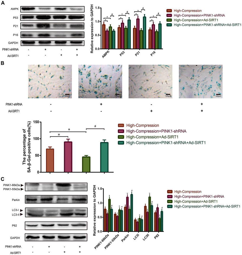 Effect of SIRT1-overexpression on high-compression treated NP cells under inhibition of mitophagy. (A) PINK1-shRNA was used to silence the endogenous PINK1 in NP cells before high-compression and Ad-SIRT1 treatments. The expression levels of senescence-related biomarkers (AMPK, P53, P21 and P16) in each group were analyzed by Western blotting. (B) The degree of senescence of the NP cells in each group was assessed by optical microscopy after SA-β-Gal staining (200×). (C) The expression levels of mitophagic biomarkers (PINK1, Parkin, LC3II/I and P62) were analyzed by Western blotting. *P#P