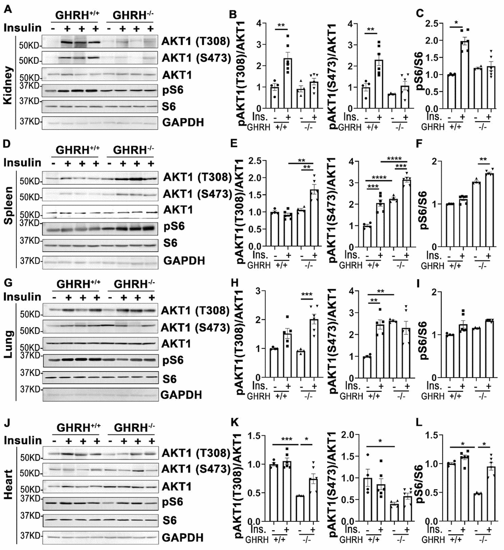 Organ-specific insulin sensitivity by activation of AKT/S6 in GHRH-/- mice. (A–C) Activation of AKT and S6 in kidney. (D–F) Activation of AKT and S6 in spleen. (G–I) Activation of AKT and S6 in lung. (J–L) Activation of AKT and S6 in heart. The mice were fasted for 4 hours before i.p. injection with porcine insulin (1 IU/kg of body weight). Tissues were collected 20 min after following insulin i.p. injection. All data (means ± sem) were expressed as fold change compared to vehicle treated WT controls (defined as 1.0) (n=4 for WT group; n=6 for GHRH-/- mice). Statistical analysis was performed by unpaired Student’s t-test, * P P P P 