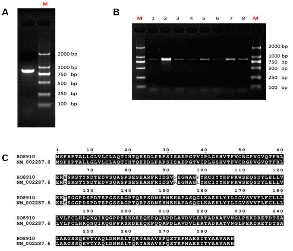 Analysis of LAIR-1 cDNA sequence in HO8910 ovarian cancer cells. (A) LAIR-1 PCR product analysis of HO8910 cells on 1% electrophoresis gel. (B) Colony PCR analysis was used to identify the recombinant positive colonies, the positive colonies were purified and subsequently sequenced. (C) The predicted amino acid sequence alignment between LAIR-1 in HO8910 cells and NM