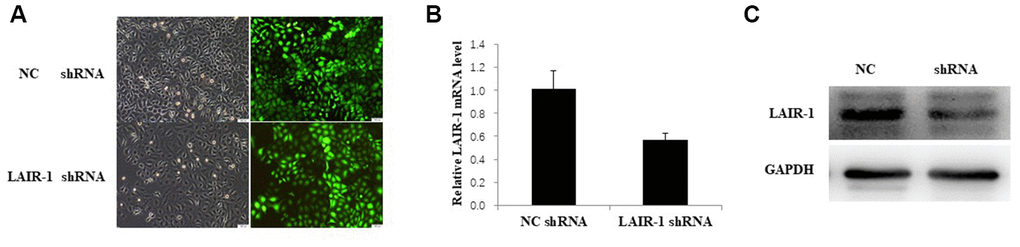 LAIR-1 knockdown HO8910 cells were constructed by transfecting with LAIR-1-RNAi-lentivirus. (A) HO8910 cells were transfected with control and LAIR-1shRNA lentivirus, the efficiency of LAIR-1 knockdown was examined by fluorescence microscope. (B, C) qRT-PCR and western blot were also used to further confirm the efficiency of LAIR-1 knockdown in HO8910 cells.