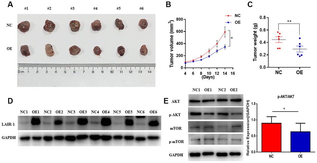 LAIR-1 inhibits ovarian cancer cell growth in vivo. Nude BALB/c mice were subcutaneously injected with control (NC) and LAIR-1 overexpression SKOV3 cells (OE). (A) The tumor tissues obtained from mice were imaged using a digital camera (B). Tumor volume in each mouse was monitored every two days. Data are presented as mean ± SE (n = 6). (C) The tumors tissues were weighed by analytical balance. Data are presented as mean ± SE (n = 6). (D) Western blot analyses of LAIR-1 expression in tumor tissues derived from control and LAIR-1 overexpression SKOV3 cells. GAPDH was used as a loading control. (E) Western blot analyses of p-AKT, AKT, p-mTOR, mTOR pathways in tumor tissues derived from control and LAIR-1 overexpression SKOV3 cells. GAPDH was used as a loading control.