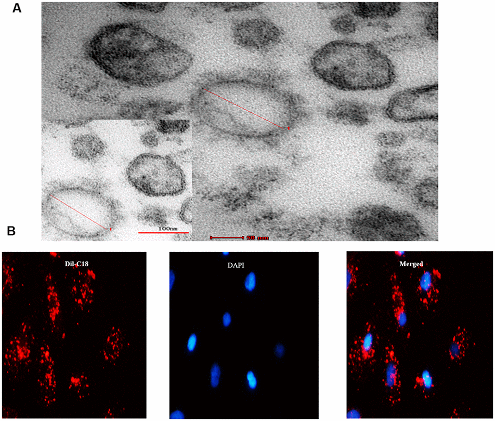 MVs derived from cell culture media. (A) Transmission electron microscopy (TEM) micrograph of EVs isolated from cell culture media. (B) Microscopy image showed the internalization of fluorescently labeled EVs into recipient HPTCs with Dil-C18 (red).