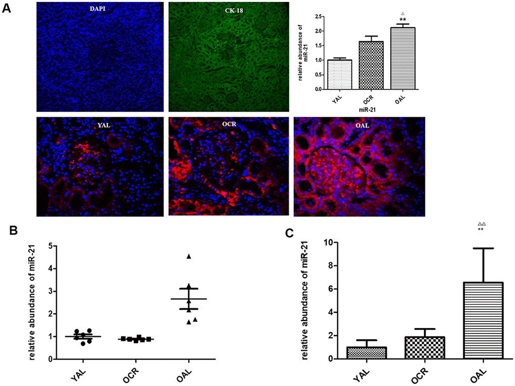 miR-21 expression in rat kidney tissue detected by FISH and qPCR. (A) The tubular epithelial cells were marked by DAPI and Cytokeratin 18 (CK-18);In situ hybridization of miR-21 in renal biopsies of rats in YAL and OAL; Quantification of in situ hybridization results. **PB) Comparison of miR-21 level in tissues. Black triangles indicated the irrelative miR-21 abundance. The black lines represented the means of miR-21 abundance. Statistical significance was present between OAL, YAL and OCR groups. (C) Comparison of miR-21 level in urine EVs. qRT-PCR analyses of miR-21 by relative quantification respectively. ** p ΔΔp 
