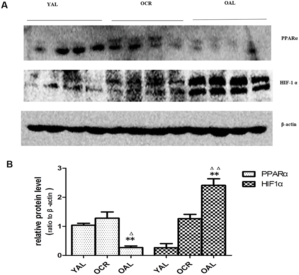 Expression of PPARα and HIF-1α in the kidneys of three groups. (A) Western blot results for PPARα and HIF-1α protein. (B) Quantitative analysis of band density for PPARα and HIF-1α. Data are presented as mean ± SD (n=4). * p Δp ΔΔp 