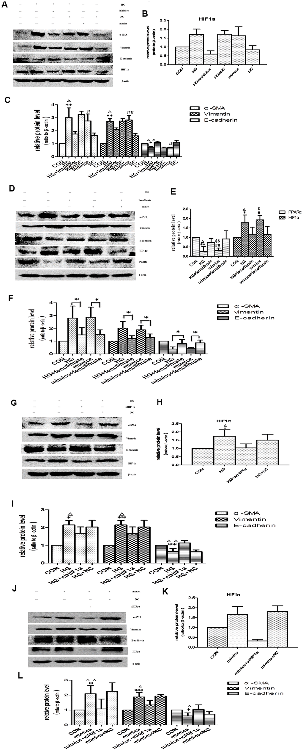 Effects of miR-21 on PPARα/HIF-1α signaling. (A) Cells incubated under normal glucose (CON), high glucose (HG), miR-21 mimics, HG+miR-21 inhibitor, miR negative control (NC), and HG+NC for 48h were harvested for Western blot analysis of EMT marker and HIF-1α signaling. (B, C) Quantitative analysis of band density for E-cadherin, α-SMA, vimentin and HIF-1α. Data are presented as mean ± SD. * p Δp # p ΔΔ/## pD) Cells incubated under CON, HG, miR-21mimics, HG+fenofibrate, miR-21mimics+fenofibrate for 48h were harvested for Western blot analysis of EMT marker and PPARα/HIF-1α signaling. (E, F) Quantitative analysis of band density for E-cadherin, α-SMA, vimentin, PPARα and HIF-1α. Data are presented as mean ± SD. * p Δp # p $ p ΔΔ/##/$$ pG) HPTCs treated with CON, HG, HG+ siHIF-1α, and HG+ si-con (NC) for 48 h were harvested for Western blot analysis of EMT marker and HIF-1α signaling. (H, I) Quantitative analysis of band density for E-cadherin, α-SMA, vimentin and HIF-1α. Data are presented as mean ±SD. *p Δp ΔΔpJ) HPTCs treated with CON, miR-21mimics, miR-21mimics+siHIF-1α, and miR-21mimics+si-con (NC) for 48 h were harvested for Western blot analysis of EMT marker and HIF-1α signaling. (K, L) Quantitative analysis of band density for E-cadherin, α-SMA, vimentin and HIF-1α. Data are presented as mean ± SD. * p Δp ΔΔp