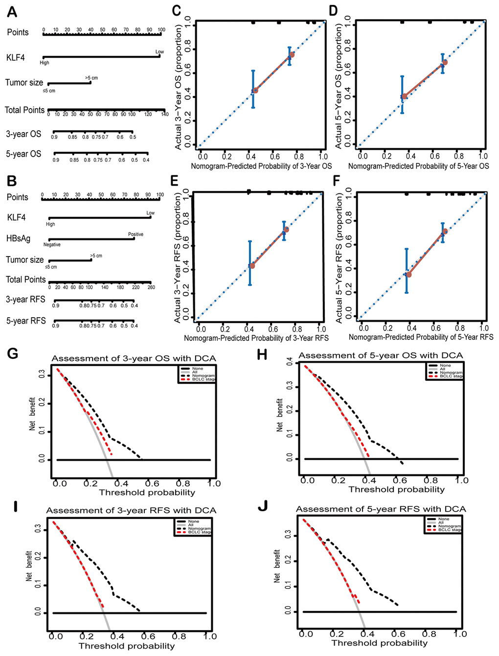 Nomograms and decision curves analyses were to further study the effect on the prognosis of KLF4. Pictures (A) and (D) showed the predictive analysis through prognostic nomogram. First, the plumb line between each factor and the point scale was drawn, and then got the point of each factor. The sum of the points of all factors is the total set of points. finally, a plumb line was drawn from all point scales to the probability scale to obtain the probability of OS or RFS. 3- year and 5- year OS (B and C) and 3-year and 5- year RFS (E and F) were shown by calibration curves. The X-axis represented the predicted value of OS or RFS by nomograms and the Y-axis represented actual OS or RFS. The clinical effects of different models were exhibited by decision curve analyses. The comparison of predictions between nomogram-predicted and conventional staging system for 3-year OS and RFS (G and H) and 5-year OS and RFS was shown (I and J). BCLC: Barcelona Clinic Liver Cancer staging. Dashed lines: The probability of the clinical net benefit crossing a certain threshold; the solid black horizontal line: to suppose no patients suffer the incident; the gray solid line: to assume all patients suffer the incident.